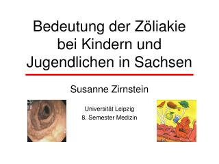 Bedeutung der Zöliakie bei Kindern und Jugendlichen in Sachsen