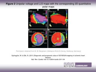 Figure 2 Unipolar voltage and LLS maps with the corresponding 2D quantitative polar maps