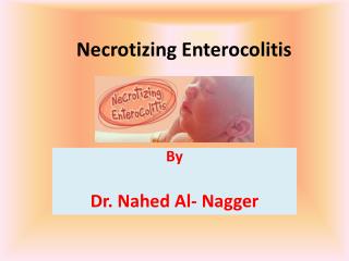 Necrotizing Enterocolitis