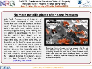 No more metallic plates after bone fractures