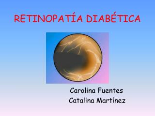 RETINOPAT Í A DIABÉTICA