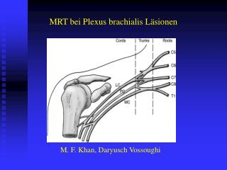 MRT bei Plexus brachialis Läsionen
