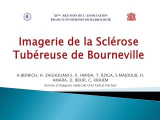 Imagerie de la Sclérose Tubéreuse de Bourneville