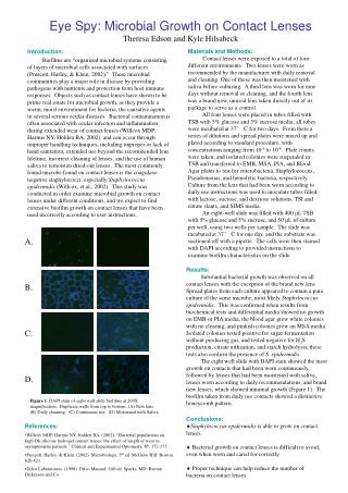 Eye Spy: Microbial Growth on Contact Lenses Theresa Edson and Kyle Hilsabeck