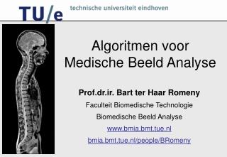 Algoritmen voor Medische Beeld Analyse