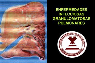 ENFERMEDADES INFECCIOSAS GRANULOMATOSAS PULMONARES