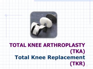 TOTAL KNEE ARTHROPLASTY (TKA) Total Knee Replacement (TKR)