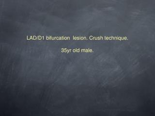 LAD/D1 bifurcation lesion. Crush technique. 35yr old male.
