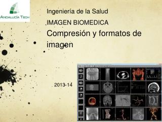 Ingeniería de la Salud IMAGEN BIOMEDICA C ompresión y formatos de imagen