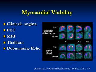 Myocardial Viability