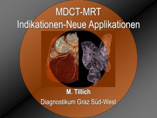 MDCT-MRT Indikationen-Neue Applikationen