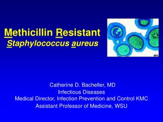 M ethicillin R esistant S taphylococcus a ureus