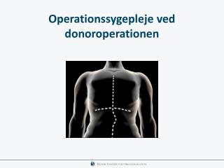 Operationssygepleje ved donoroperationen