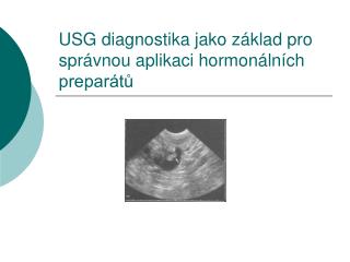 USG diagnostika jako základ pro správnou aplikaci hormonálních preparátů