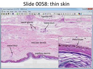 Slide 0058: thin skin