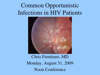 Common Opportunistic Infections in HIV Patients