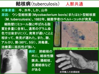 結核病 （ tuberculosis ）　 人獣共通