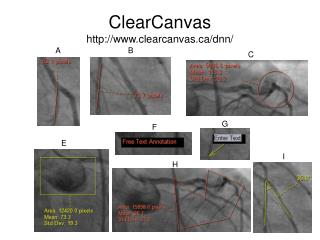 ClearCanvas clearcanvas/dnn/