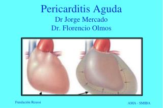 Pericarditis Aguda Dr J o rge Mercado Dr. Florencio Olmos