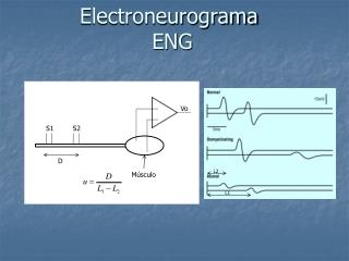 Electroneurograma ENG