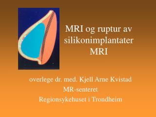MRI og ruptur av silikonimplantater MRI