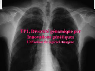 TP1, Diversité génomique par Innovations génétiques Utilisation du logiciel Anagène