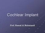 Cochlear Implant