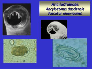 Ancilostomose Ancylostoma duodenale Necator americanus