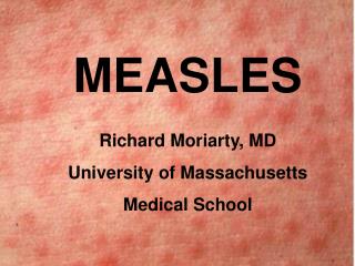 MEASLES Richard Moriarty, MD University of Massachusetts Medical School