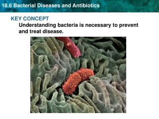 KEY CONCEPT Understanding bacteria is necessary to prevent and treat disease.
