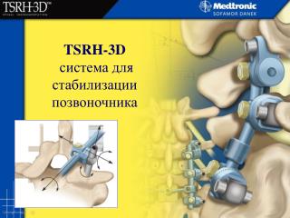TSRH-3D система для стабилизации позвоночника