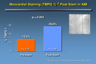 Myocardial Staining (TMPG 1)  Post-Stent in AMI
