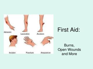 First Aid: