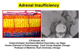 C.R.Kannan, M.D. Endocrinologist, Southwest Medical Associates, Las Vegas Former Chairman of Endocrinology, Cook Count