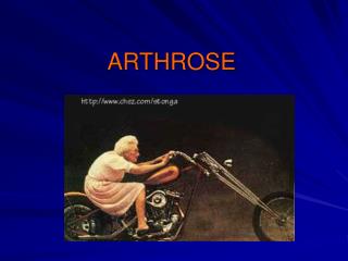 ARTHROSE