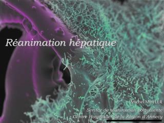 Réanimation hépatique