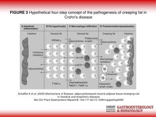 FIGURE 3 Hypothetical four-step concept of the pathogenesis of creeping fat in Crohn's disease