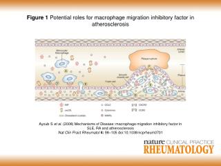 Figure 1 Potential roles for macrophage migration inhibitory factor in atherosclerosis