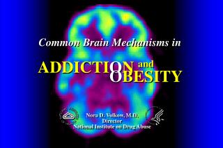 Common Brain Mechanisms in ADDICTI O N
