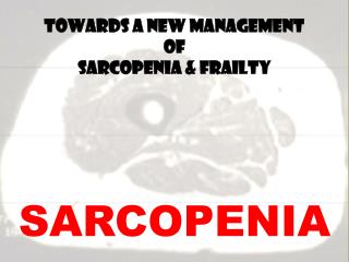 SARCOPENIA