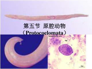 第五节 原腔动物（ Protocoelomata ）