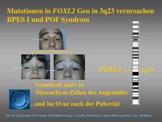 Genetisch aktiv in Mesenchym-Zellen des Augenlides