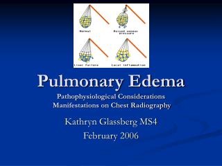 Pulmonary Edema Pathophysiological Considerations Manifestations on Chest Radiography