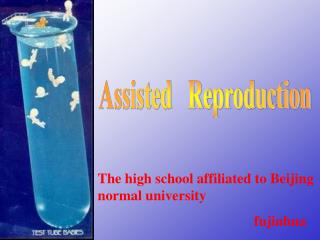 Assisted Reproduction