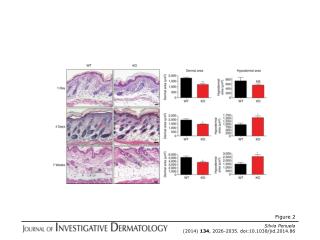 Silvia Penuela (2014) 134 , 2026-2035. doi:10.1038/jid.2014.86