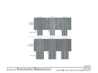 Ichiro Iwai (2012) 132 , 2215-2225. doi:10.1038/jid.2012.43