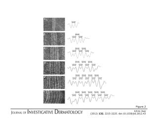 Ichiro Iwai (2012) 132 , 2215-2225. doi:10.1038/jid.2012.43