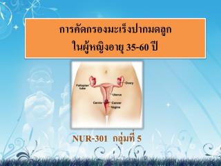 การคัดกรองมะเร็งปากมดลูก ในผู้หญิงอายุ 35-60 ปี