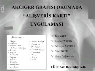 AKCİĞER GRAFİSİ OKUMADA “ALIŞVERİŞ KARTI” UYGULAMASI