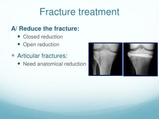 Fracture treatment